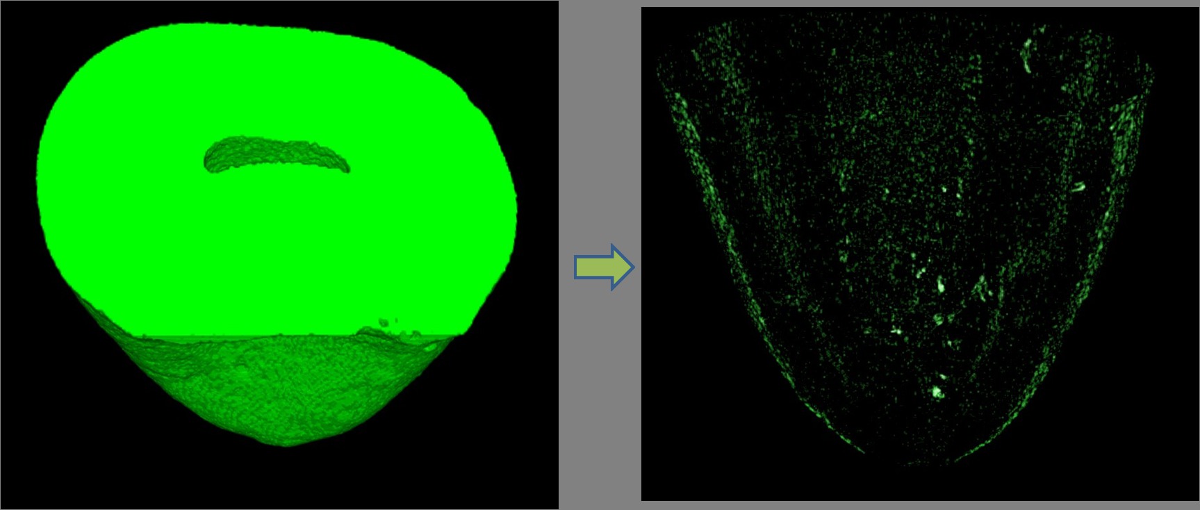 Figure 2. 3D image showed few debris (white spots) in the pre-instrumented canal.