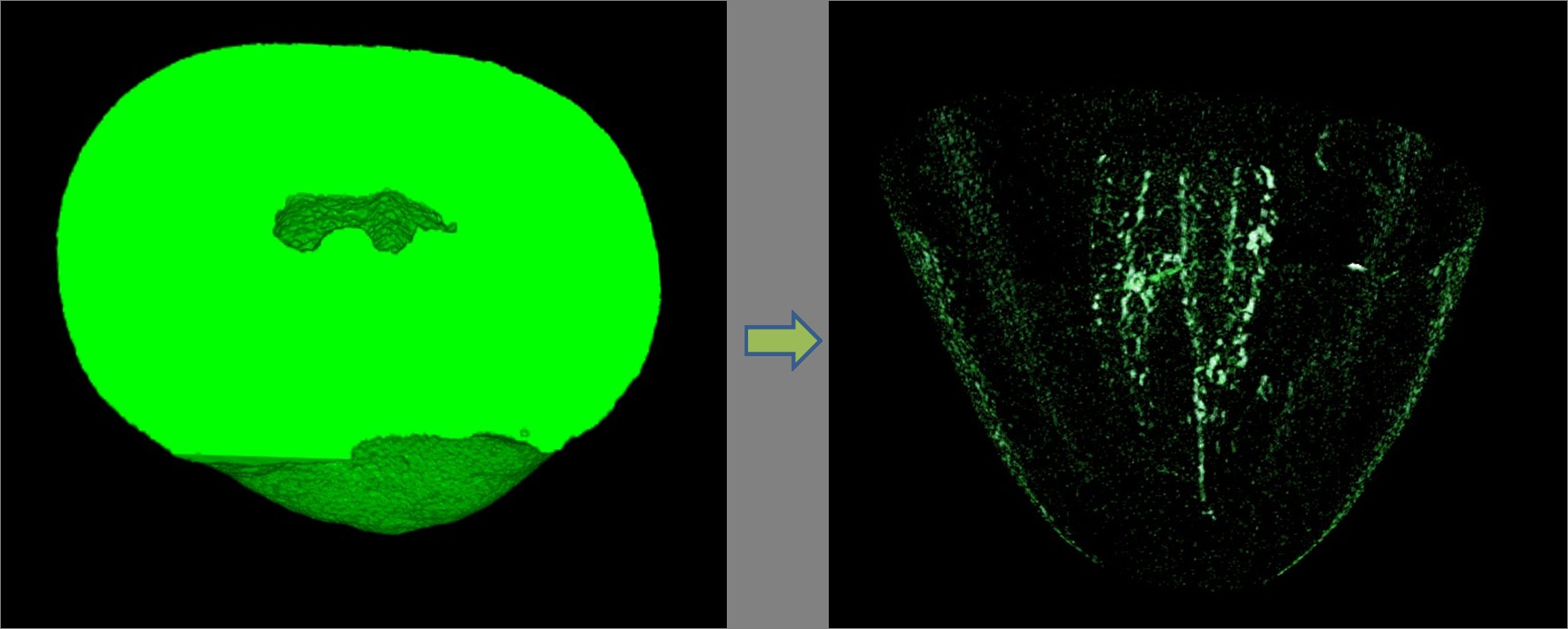 Figure 3. 3D image showed debris (white spots) accumulated along the extent of the isthmus in each canal and canal protrusion.