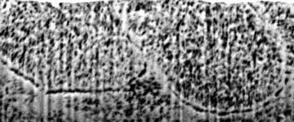 Figure1- It shows a FIB-SEM slice of white spot lesion.