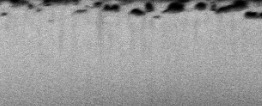 Figure2- It shows a FIB-SEM slice of normal enamel.
