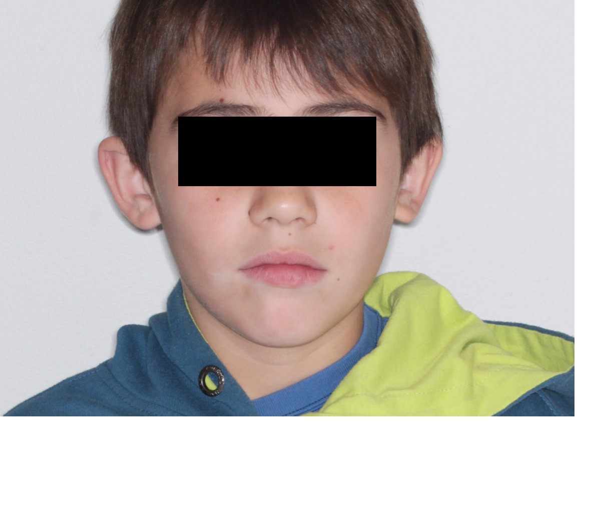 8 years old chilean boy suffering child abuse and neglect detected during clinical student attending.