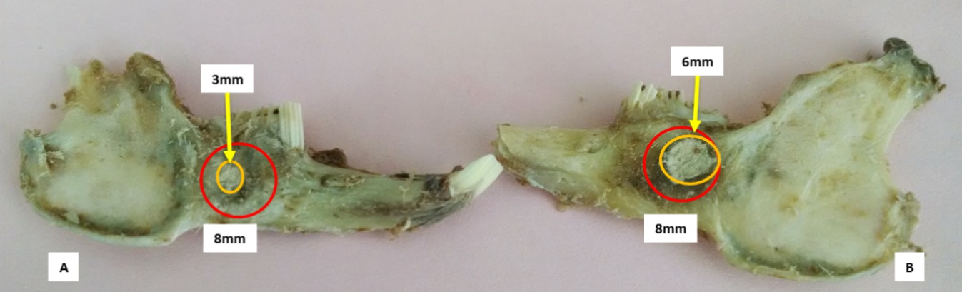 Pilot study: Clinical evaluation of bone regeneration <i>in vivo</i>