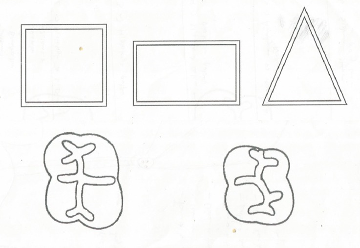 Evaluation Of The Manual Dexterity With Indirect Vision In Dental