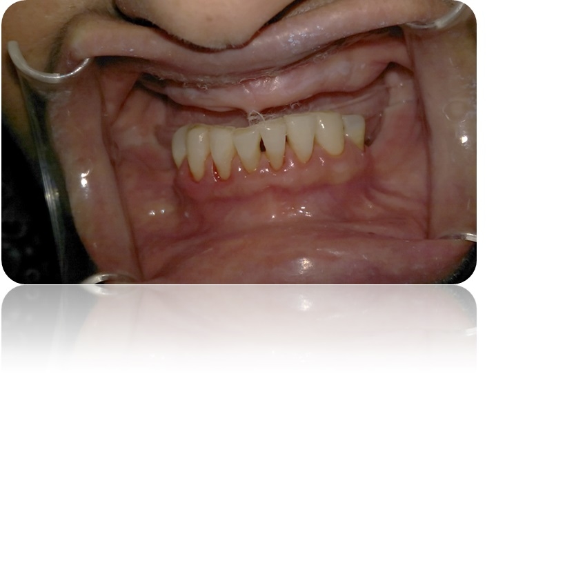 3289453_File000000.jpg