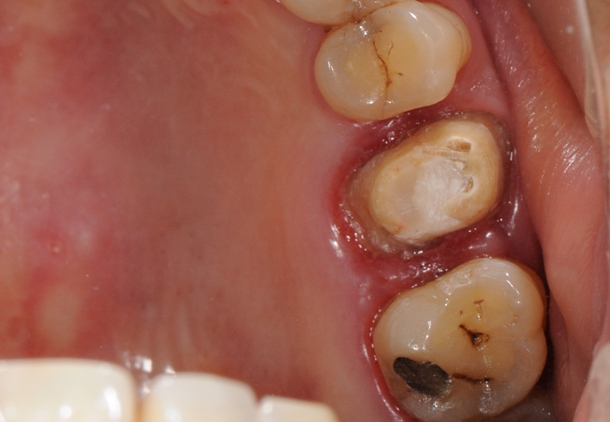 3007147_File000000.jpg